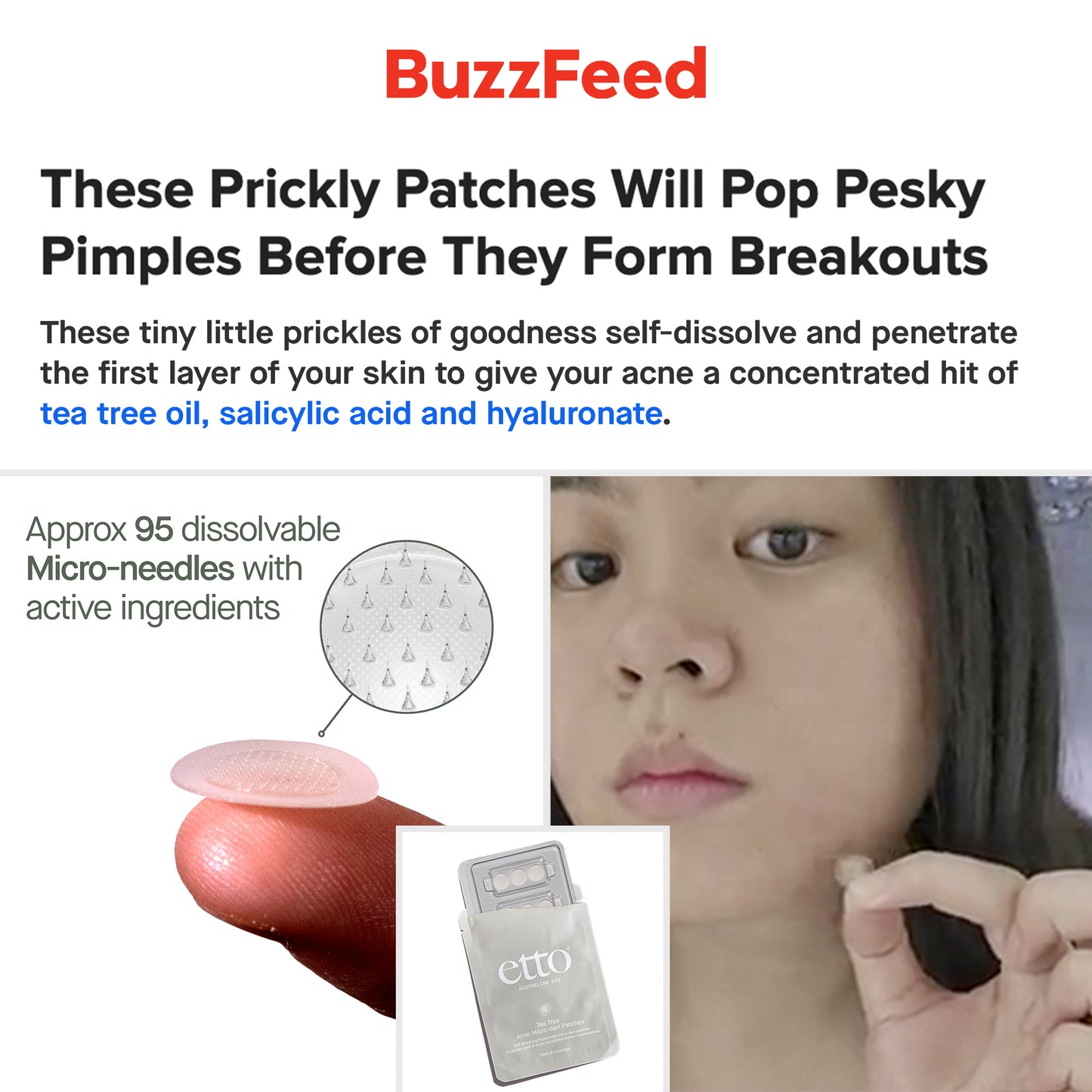 Acne Micro-dart Patches